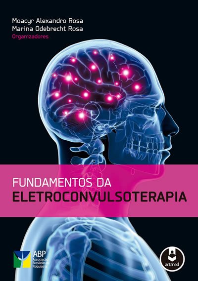 eletroconvulsoterapia em sao paulo 